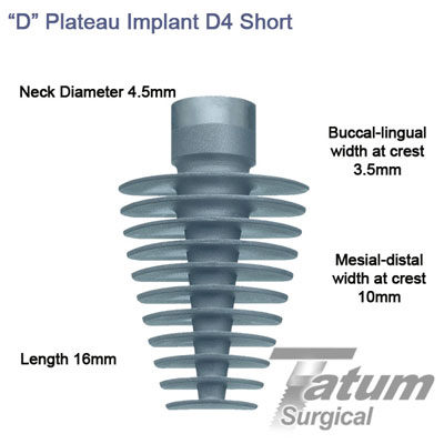 D Plateau Implants D4 4.5x16mm, Short mesial-distal 10mm