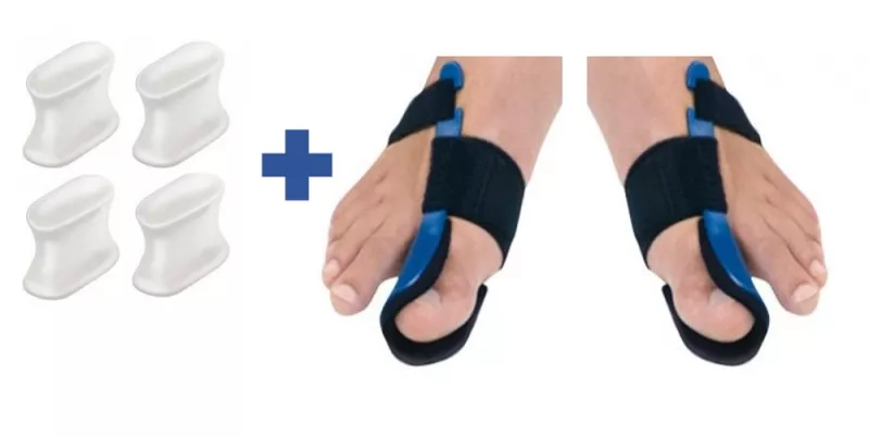 Hallux Valgus 1