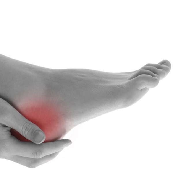 Ont i hälarna? Det kan vara hälsporre