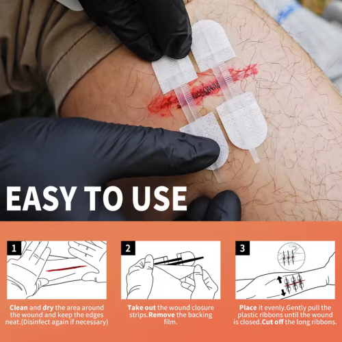 Rhino Rescue Sutur Plåster