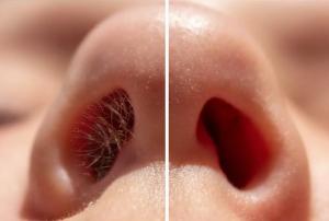 HOT STONE - STOR PAKKE