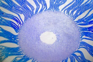 svamp under mikroskopisk förstoring - sollex blogg
